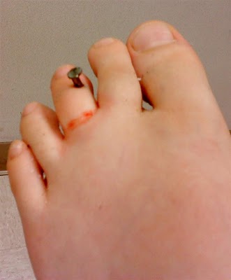 Nail 2