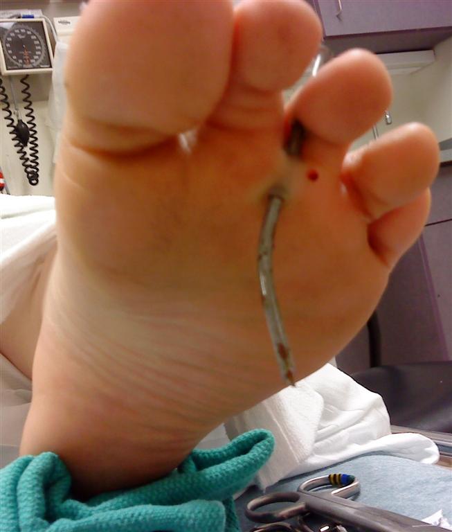Nail 4