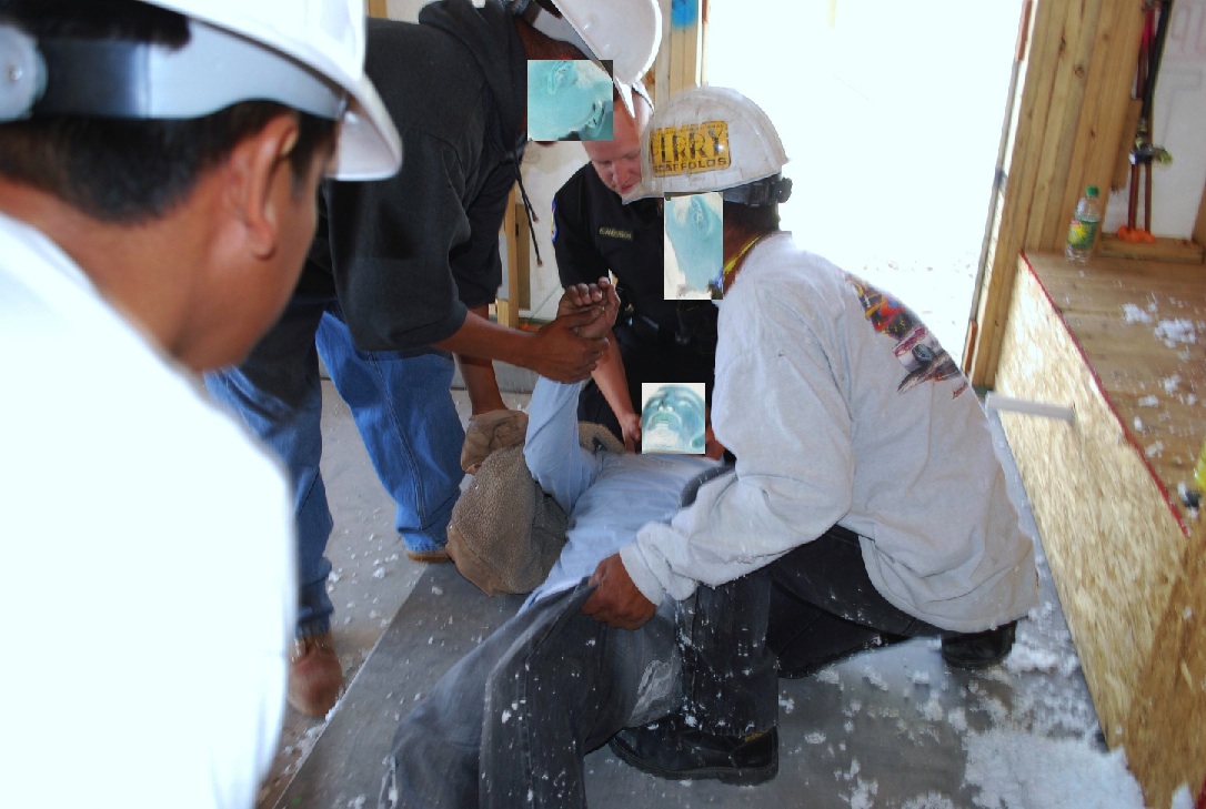 Injured Worker Face Obscured for Privacy