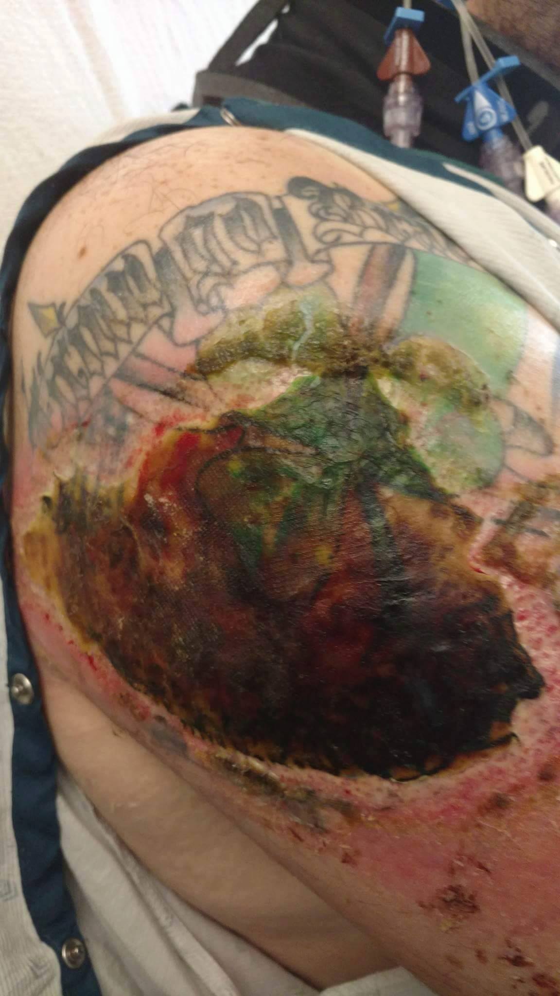 arm after